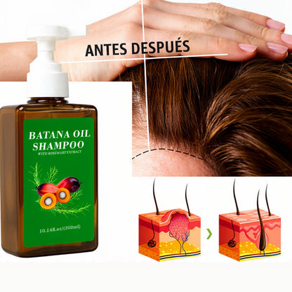 SHAMPOO DE ACEITE DE BATANA CON EXTRACTO DE ROMERO – 300 ML